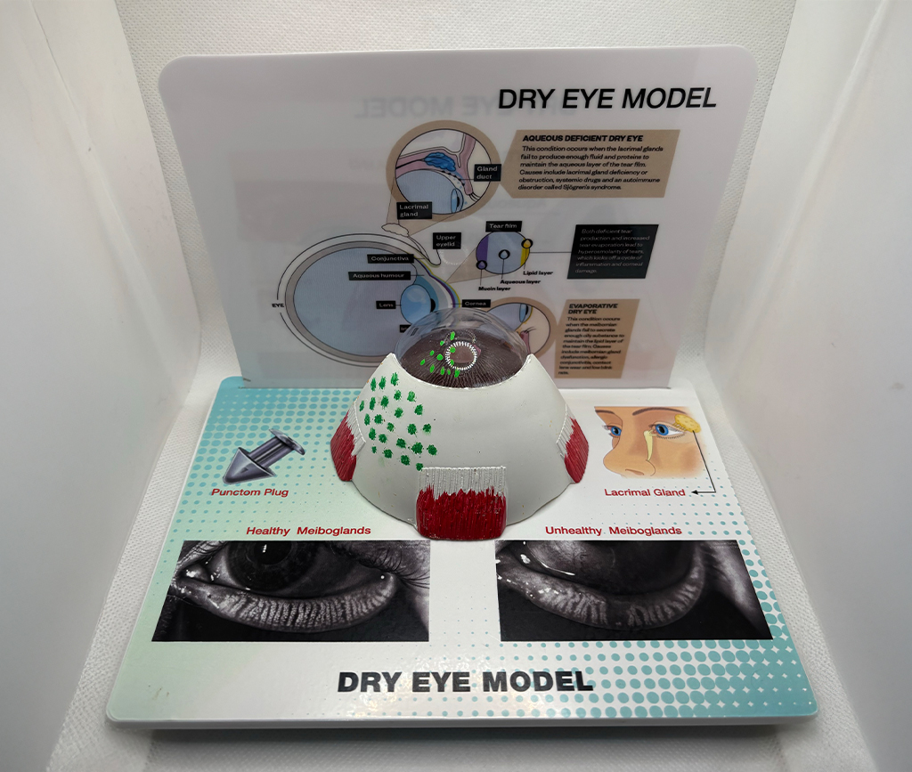 Dry Eye Model