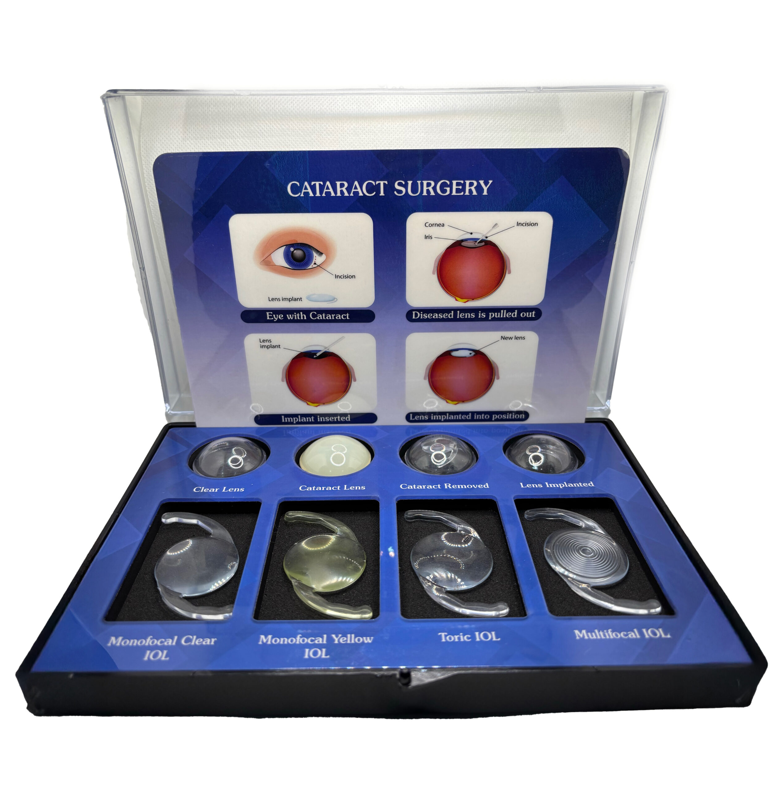 Cataract & IOL Counselling Kit