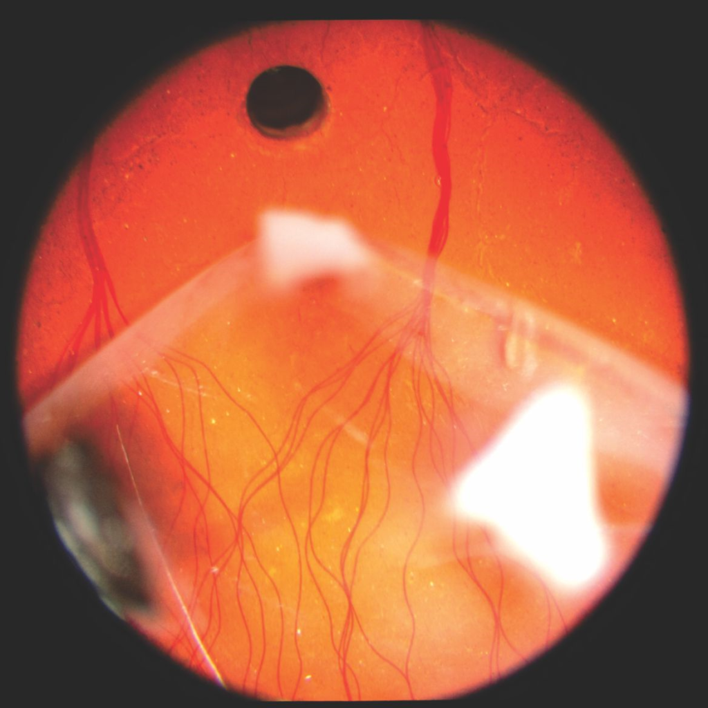 Model Eyes for Retinal Diseases