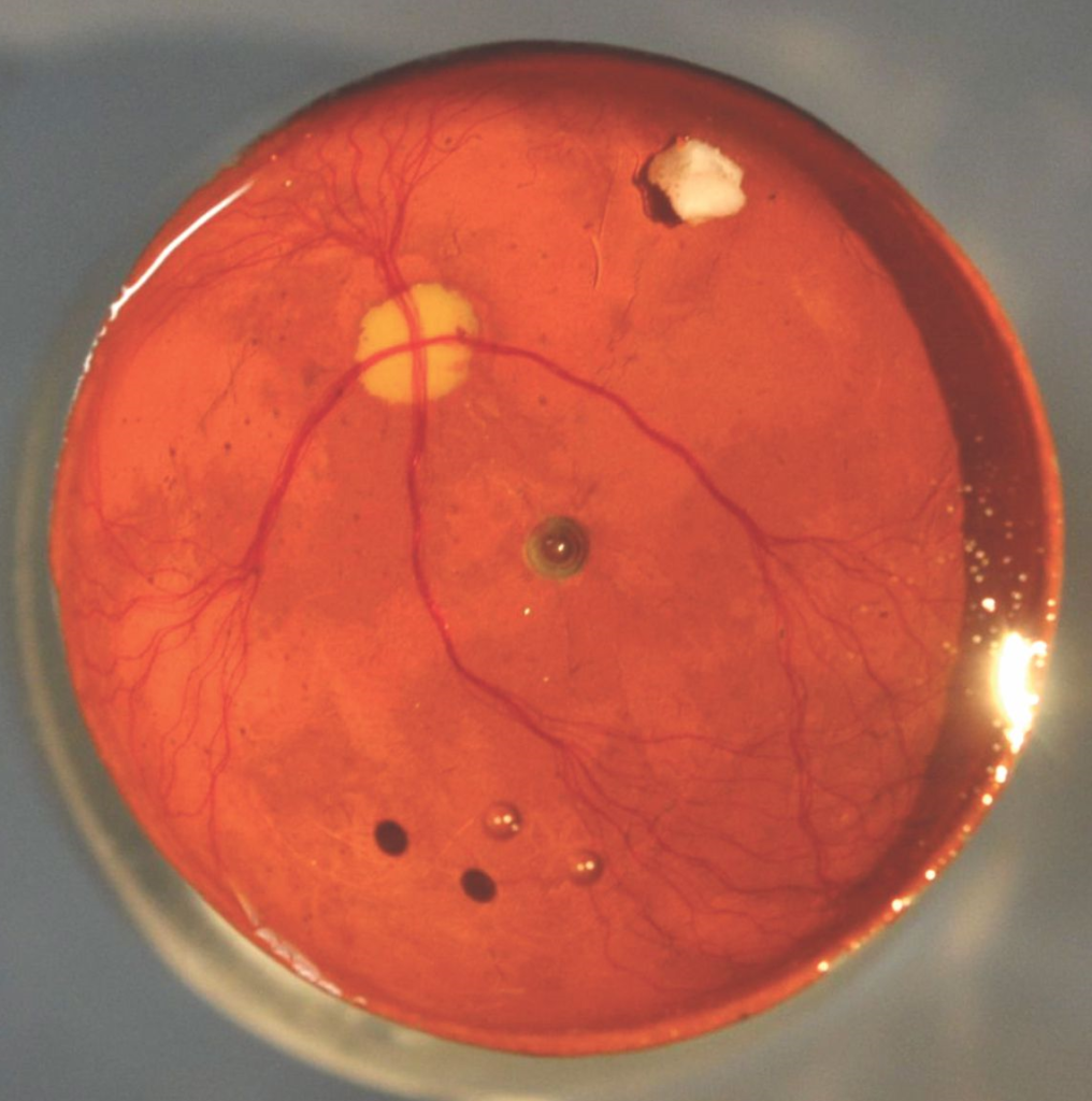 Model Eyes for Retinal Instrument’s Demonstration